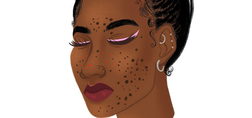 Femme noire avec acnés