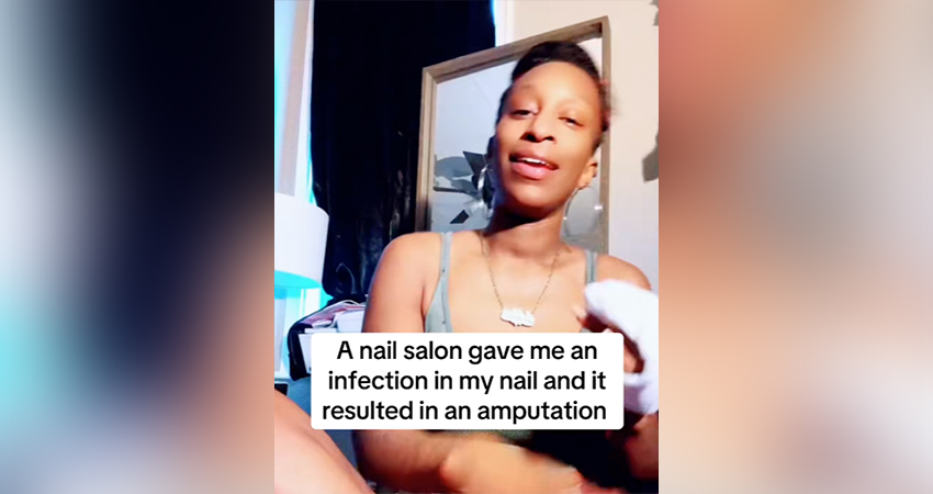 Quand une manucure vire au drame : une infection lui coûte le bout de son doigt