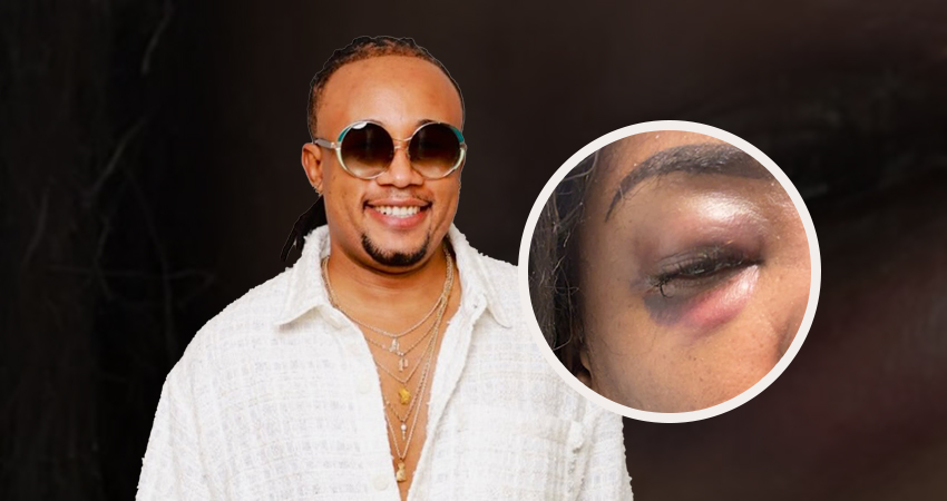 Violence domestique : l’épouse de Pedro Force brise le silence et publie des images accablantes