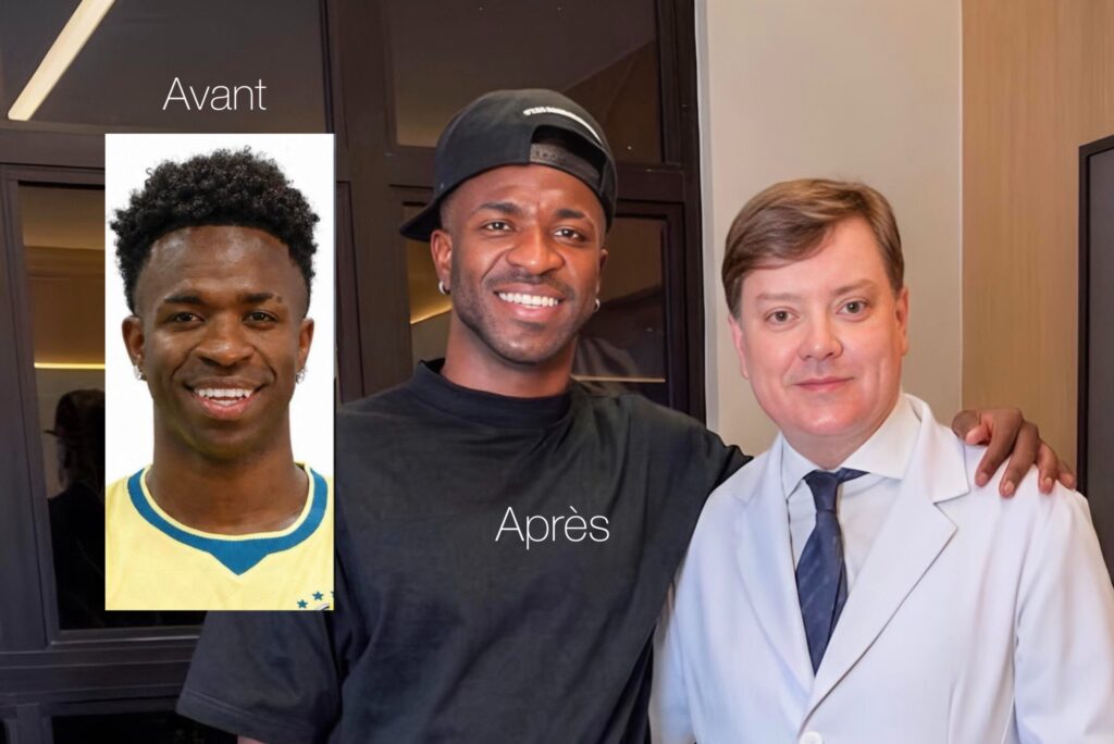 Selon plusieurs médias brésiliens, Vinícius Júnior aurait subi une intervention esthétique au menton